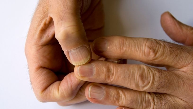 Una persona se coge los dedos de la mano como señal de angustia o ansiedad