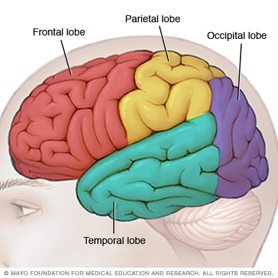 Cerebro de una persona con esquizofrenia